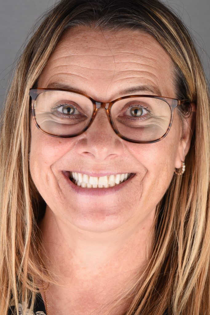 Implantes Dentários All-on-4 3 DSC