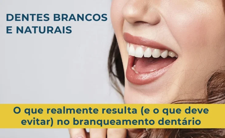 Branqueamento